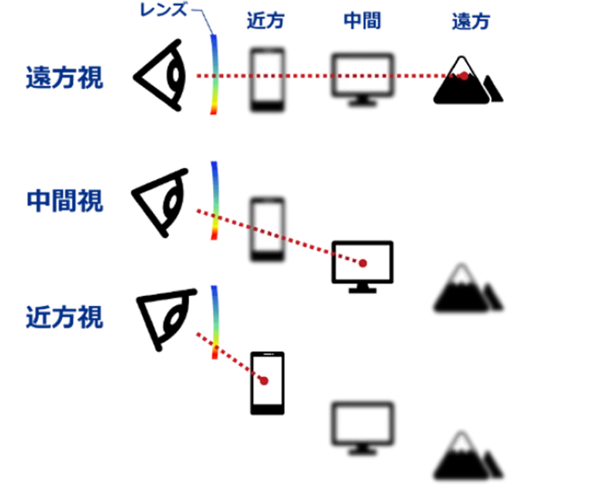 遠近両用メガネ（視標の距離によって、視線の移動が必要（交代視））