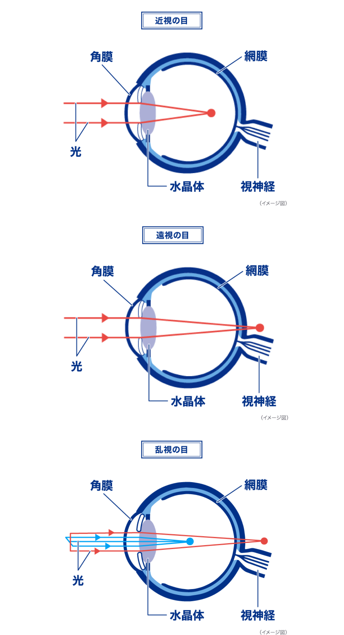 近視の目 遠視の目 乱視の目