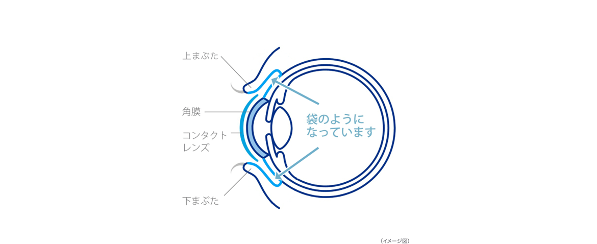 上まぶた　角膜　コンタクトレンズ　下まぶた　袋のようになっています　イメージ図