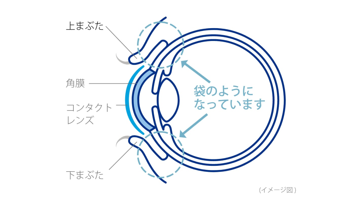 上まぶた　角膜　コンタクトレンズ　下まぶた　袋のようになっています　イメージ図