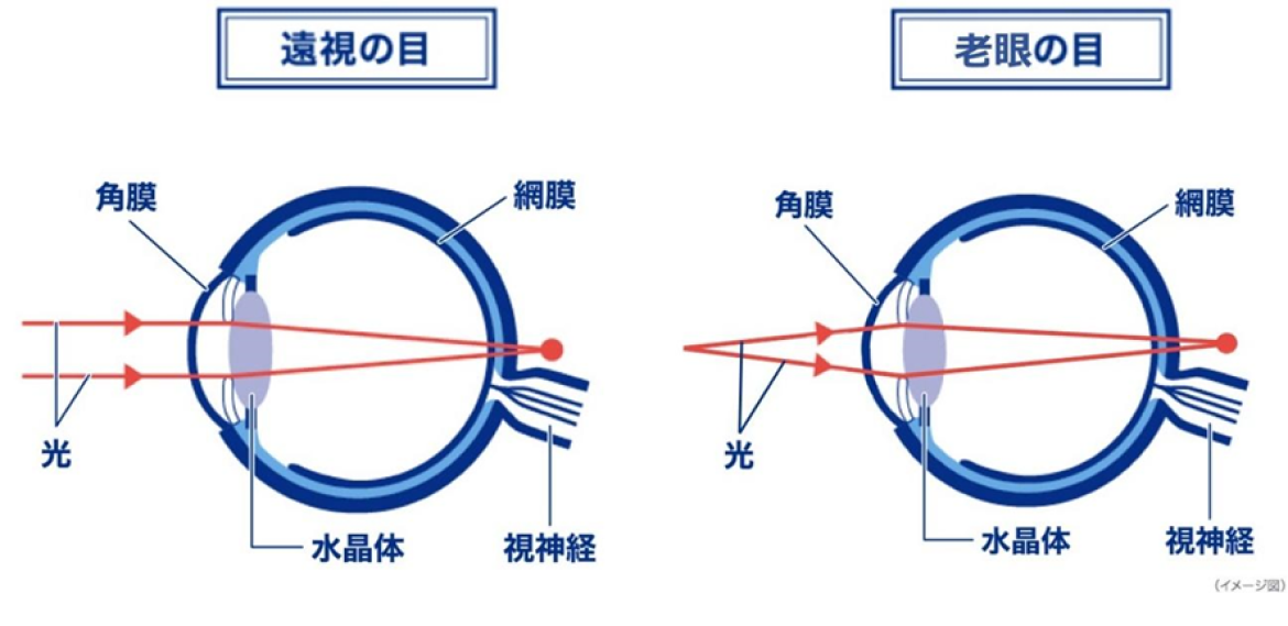 遠視の目 老眼の目