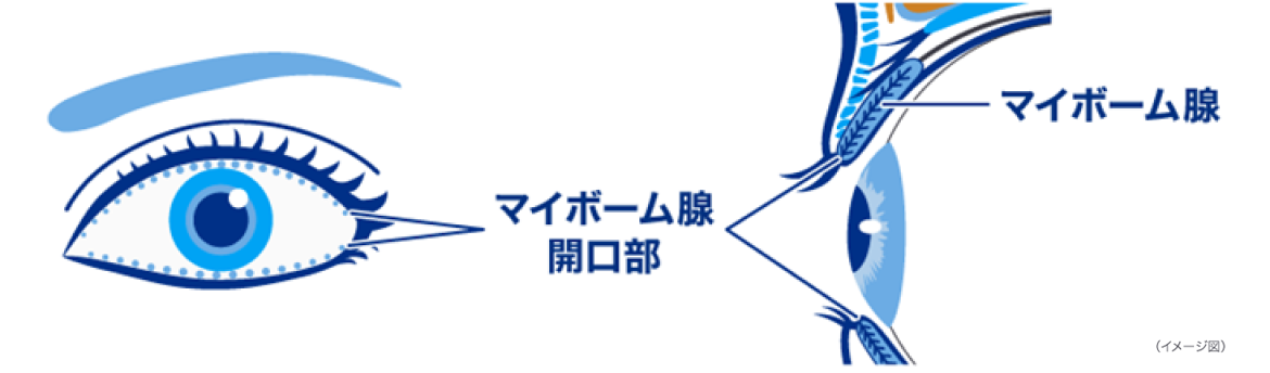 マイボーム腺 イメージ図