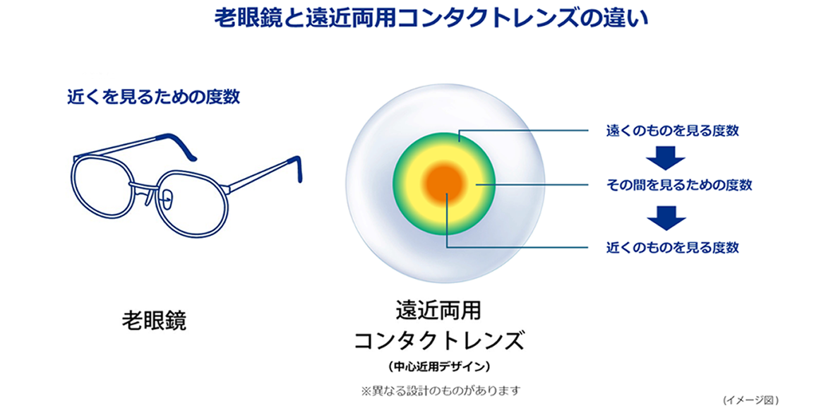 (イメージ図)老眼鏡と遠近両用コンタクトレンズの違い (イメージ図)老眼鏡と遠近両用コンタクトレンズの違い