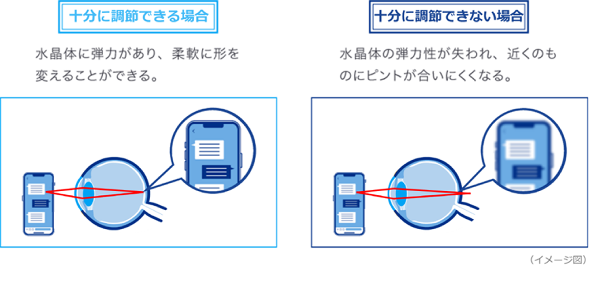 (イメージ図)水晶体の変化 (イメージ図)水晶体の変化