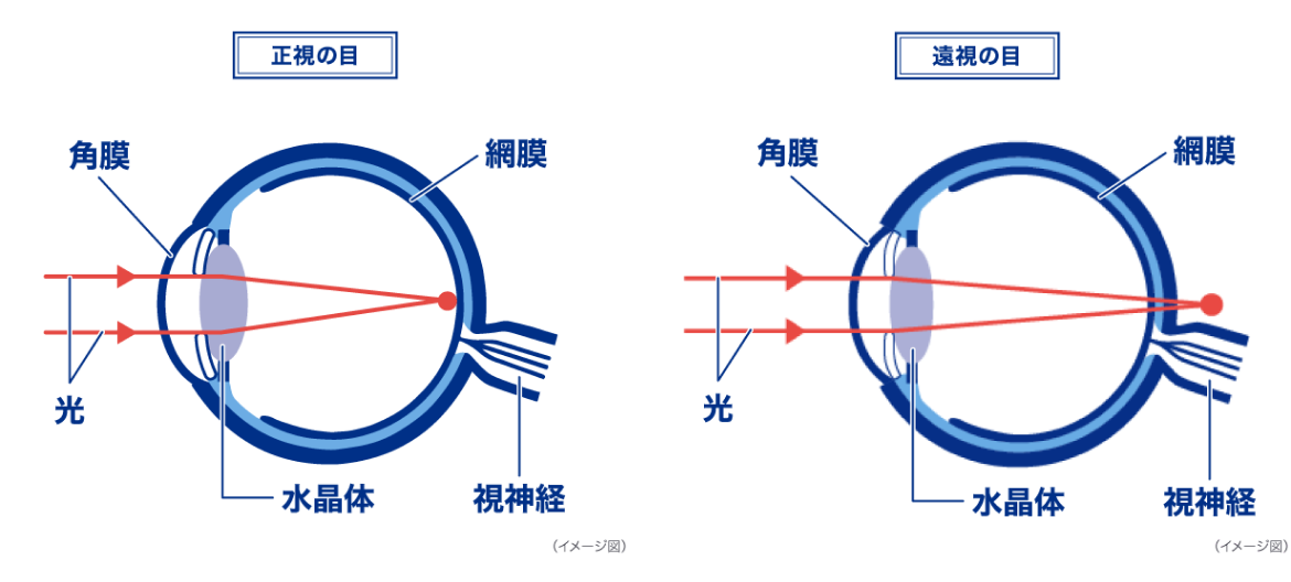 正視の目 遠視の目