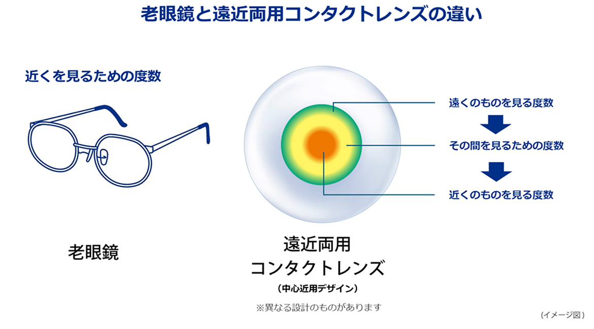眼鏡と遠近両用コンタクトレンズの違い