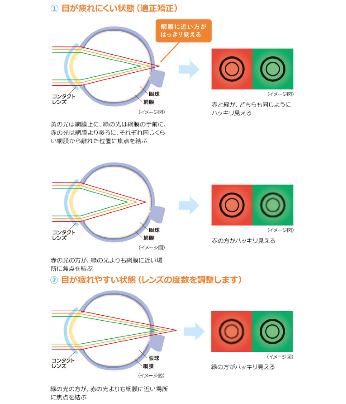 目が疲れにくい状態（適正矯正）　目が疲れやすい状態（レンズの度数を調整します）　イメージ図