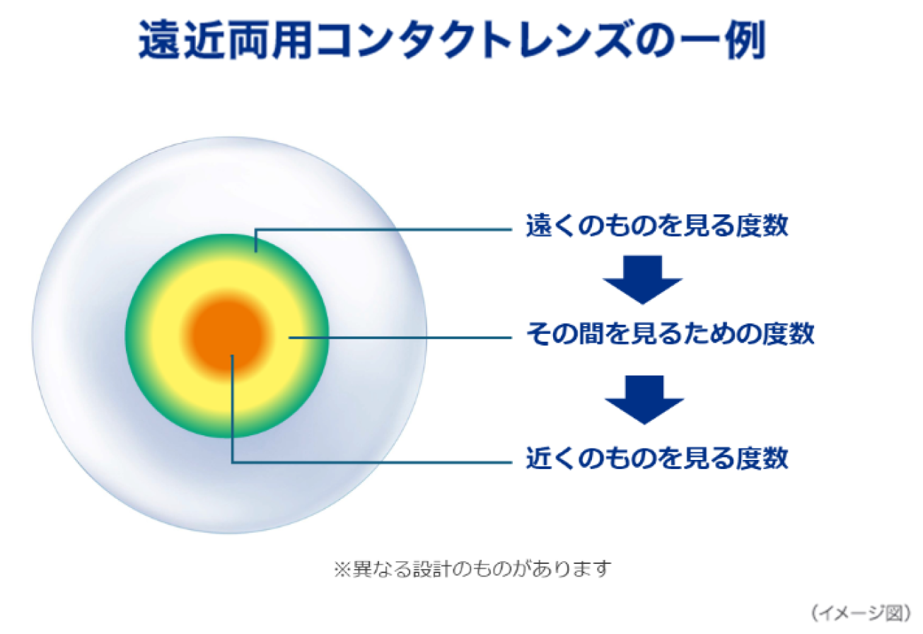 遠近両用コンタクトレンズの一例