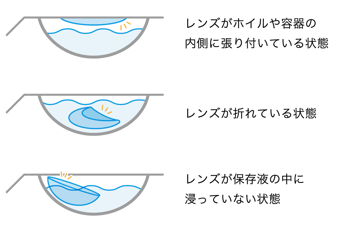 レンズがホイルや容器の内側に張り付いている状態、レンズが折れている状態、レンズが保存液の中に浸っていない状態 レンズがホイルや容器の内側に張り付いている状態、レンズが折れている状態、レンズが保存液の中に浸っていない状態