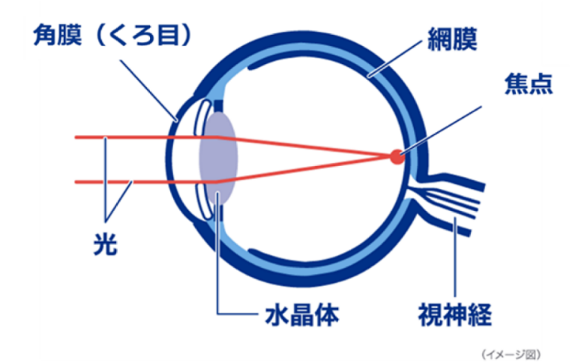 （イメージ図）正視では、目に入った光が網膜の上に焦点を結んでいる