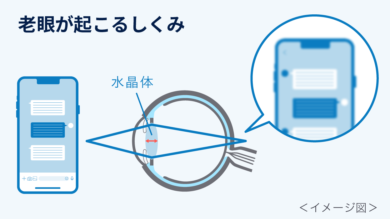 老眼が起こる仕組み