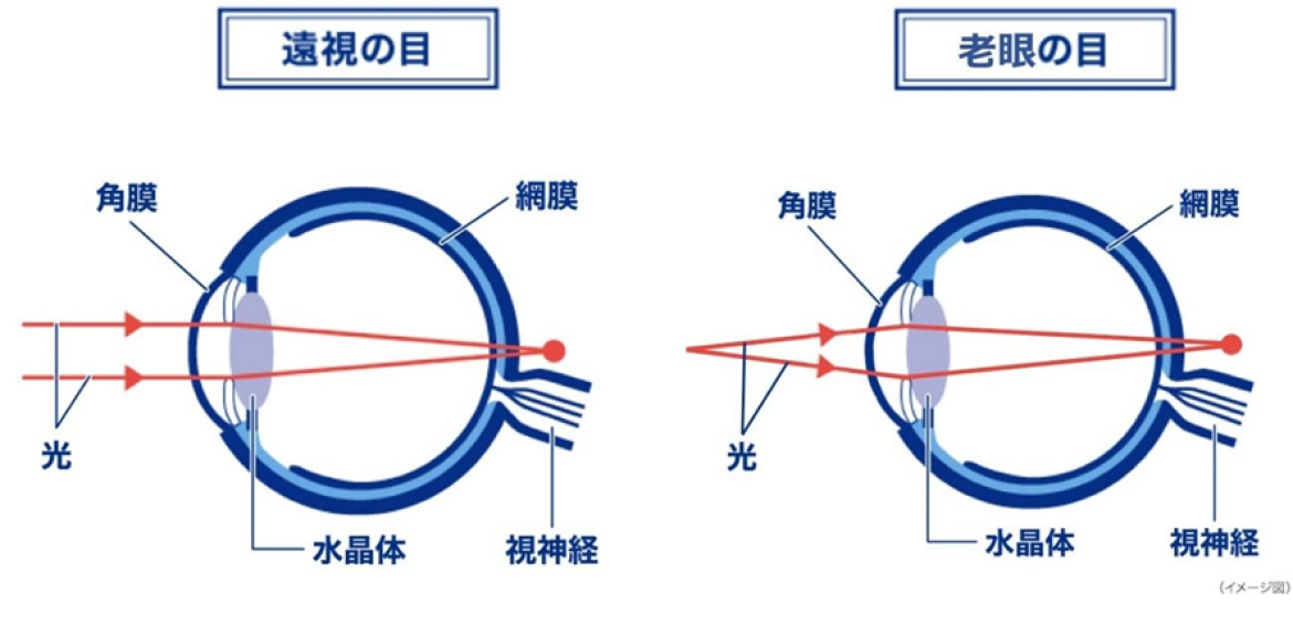 遠視の目 近視の目
