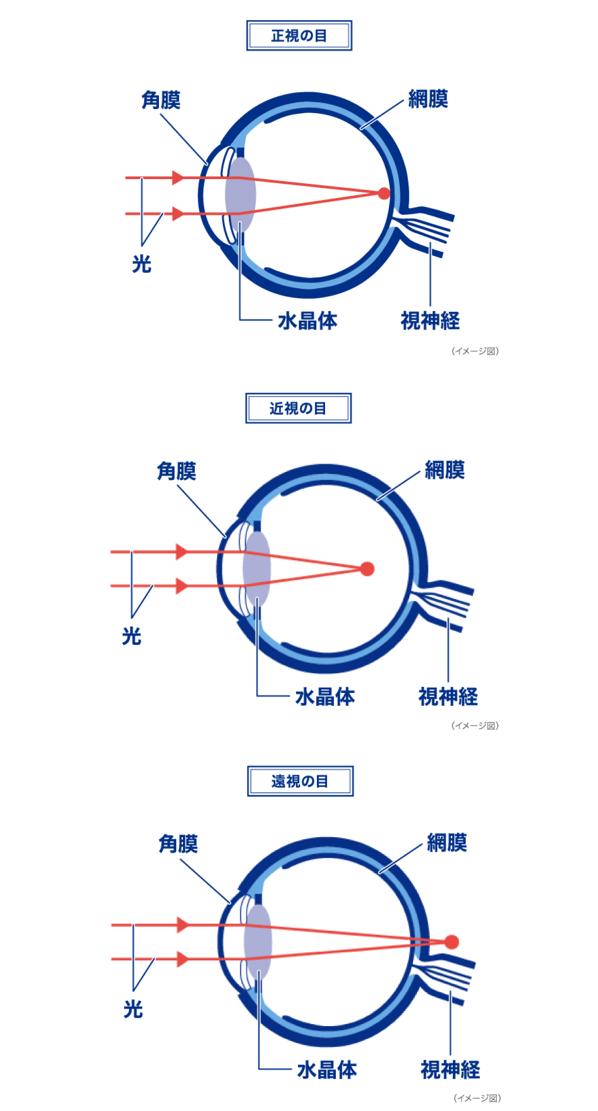 正視の目 近視の目 遠視の目