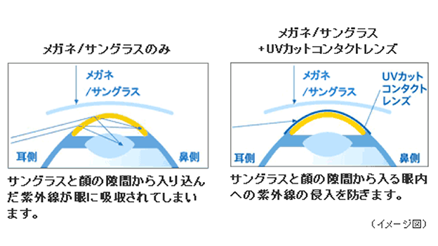 コロネオ現象とは コロネオ現象とは