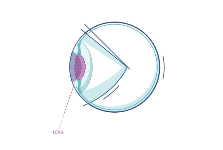 An illustration showing where the lens is in the eye.