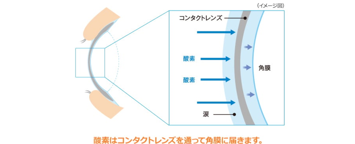 酸素はコンタクトレンズを通って角膜に届きます。