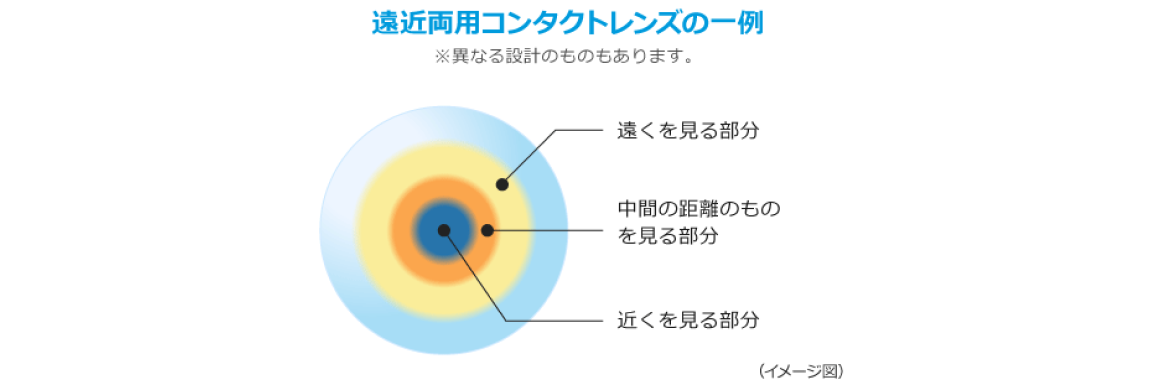 遠近両用コンタクトレンズの一例