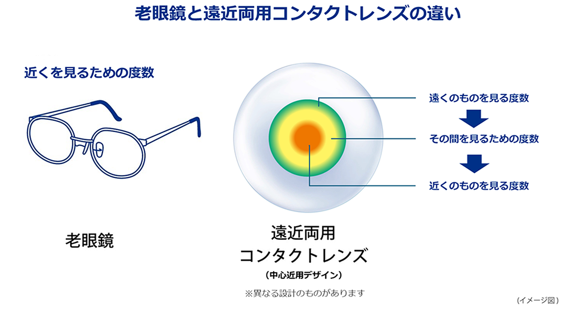 老眼鏡と遠近両用コンタクトレンズの違い 老眼鏡と遠近両用コンタクトレンズの違い