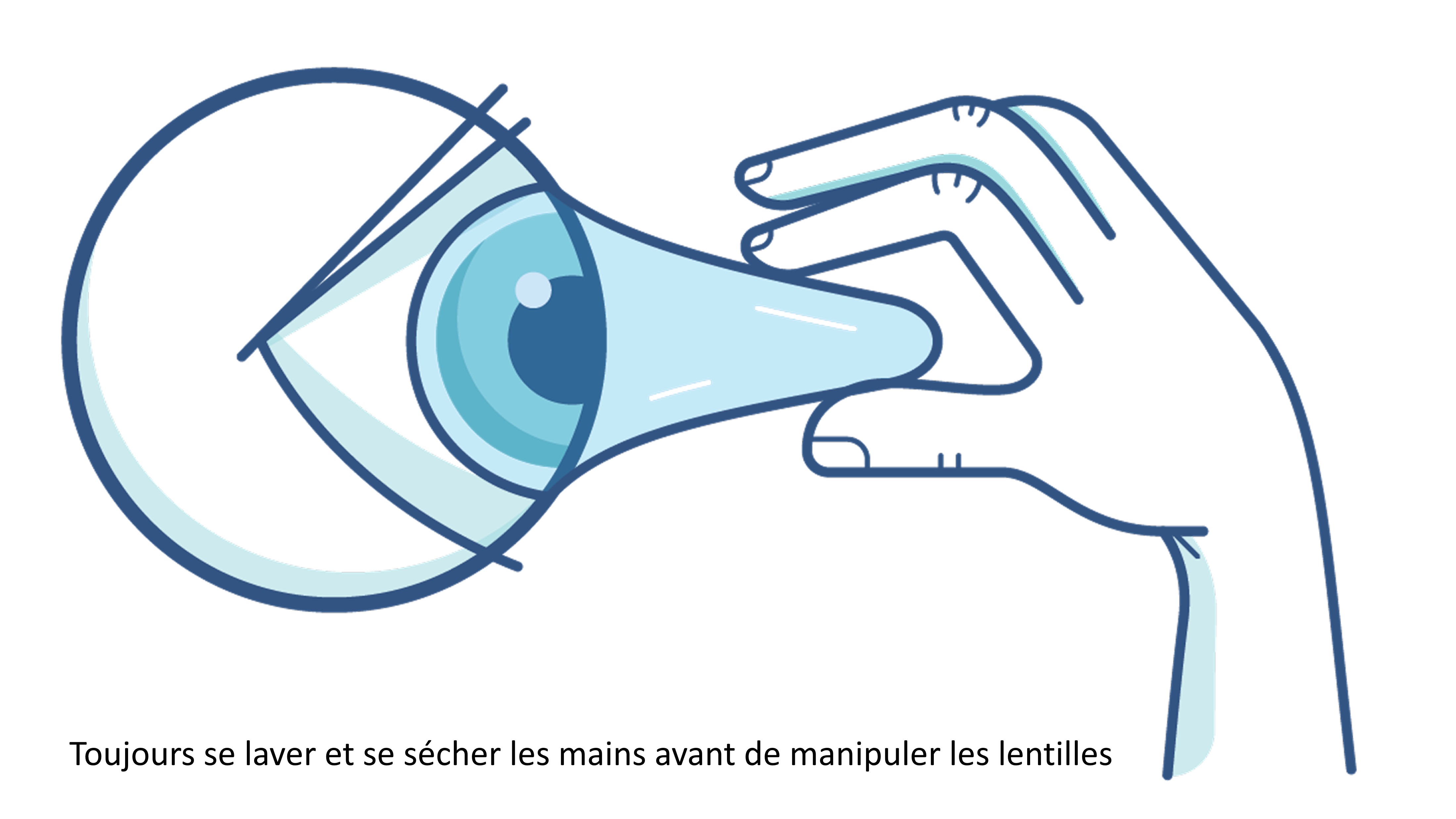 Mythe : illustration de la lentille collée sur l'œil