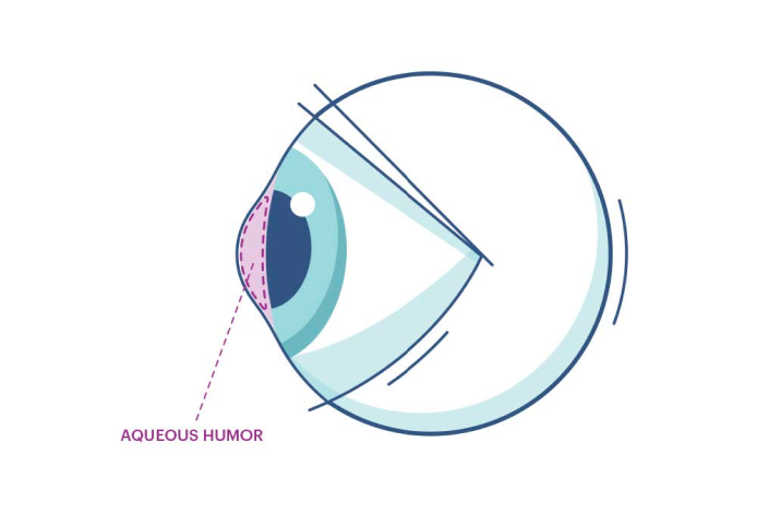 An illustration showing where the aqueous humor is in the eye.