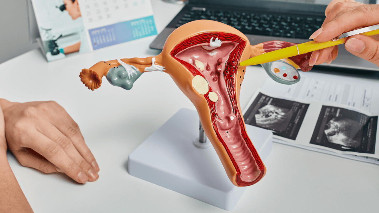 image of a women reproductive model