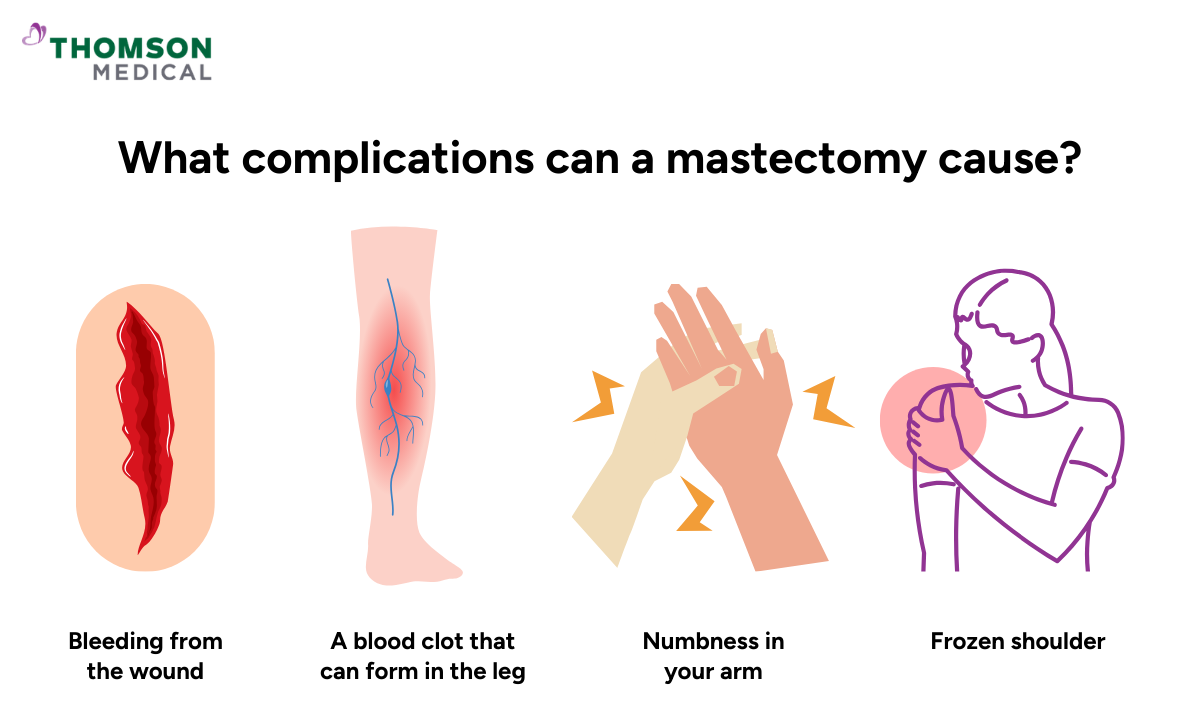 Illustration showing complications of a mastectomy