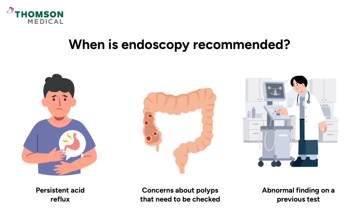 Illustration showing when a endoscopy procedure is recommended
