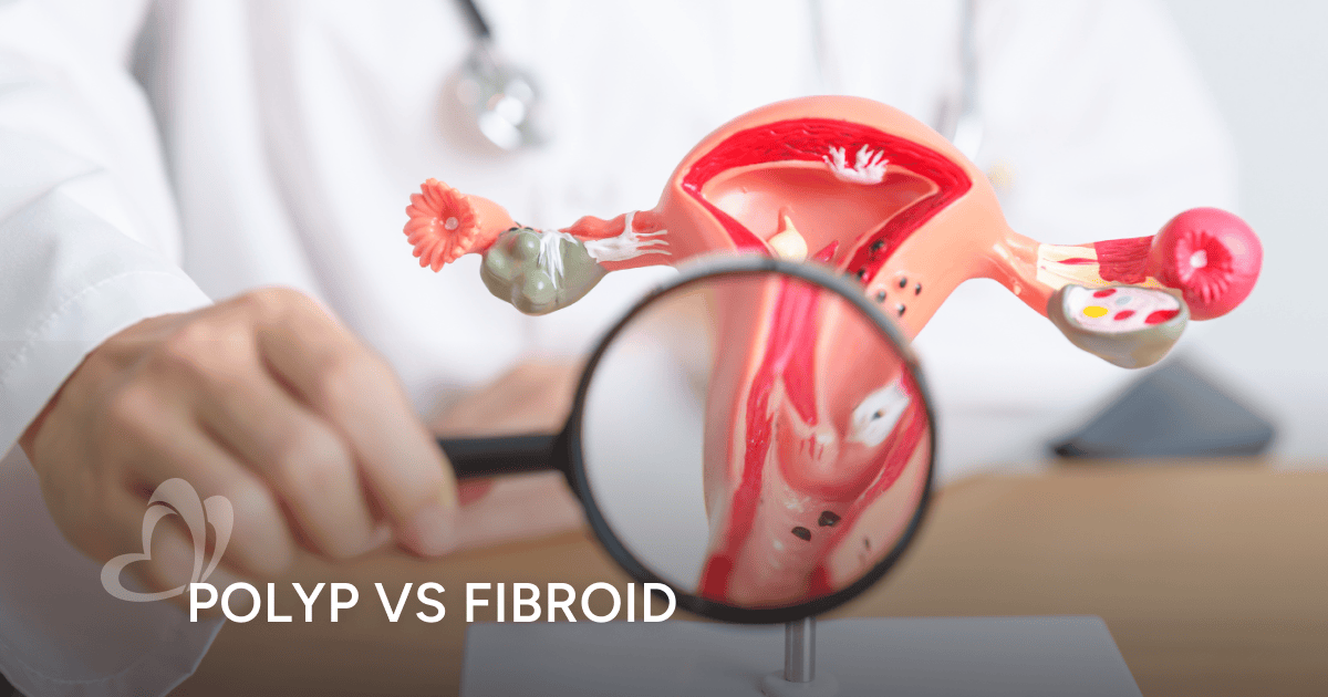 Polyps vs Fibroids in Women: What It Means for Your Health | Thomson ...