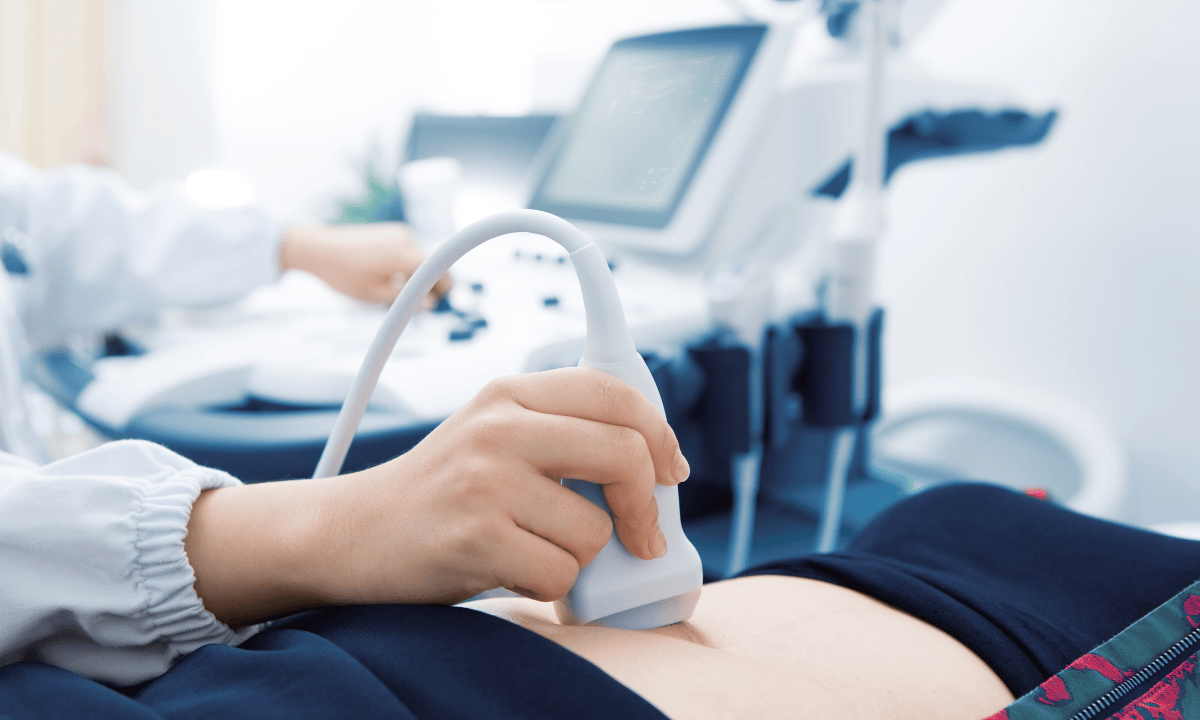 image of sonographer performing pregnancy ultrasound scan