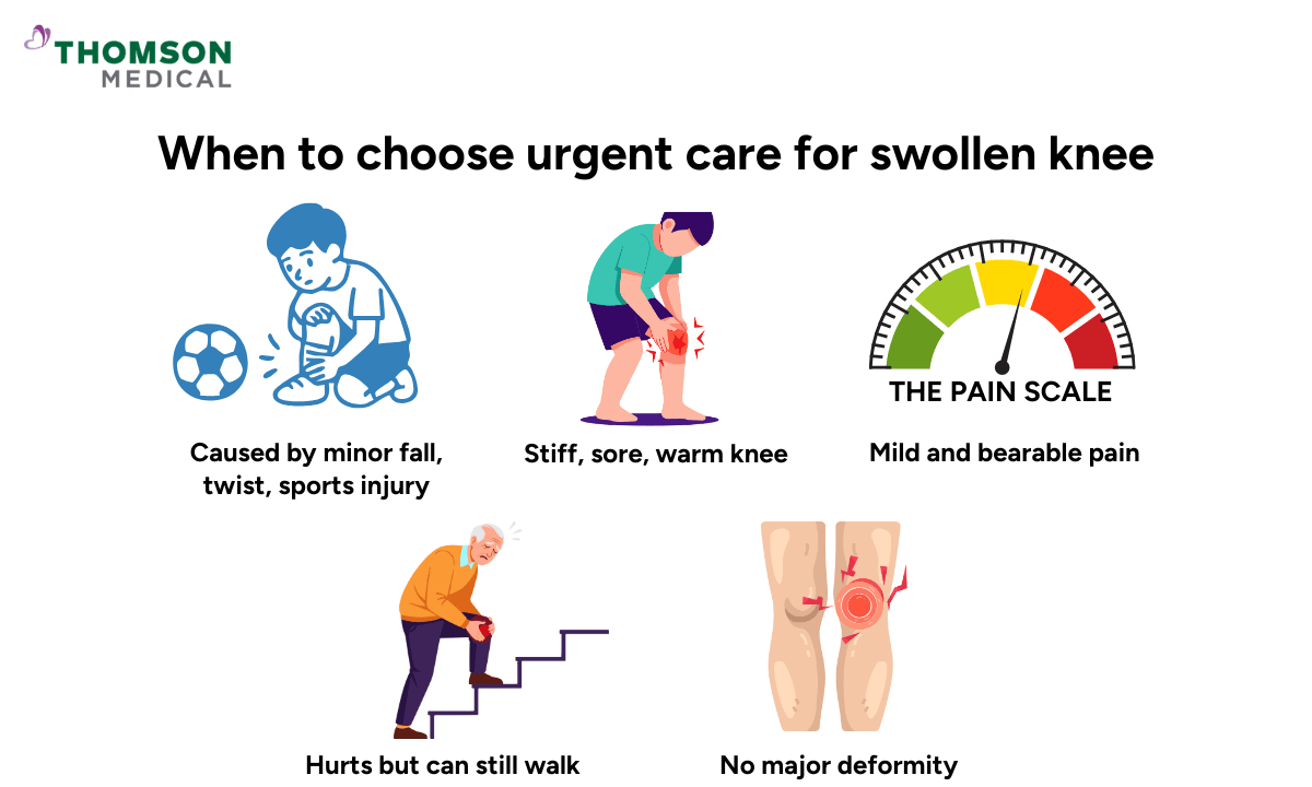 image of when to choose urgent care for swollen knee