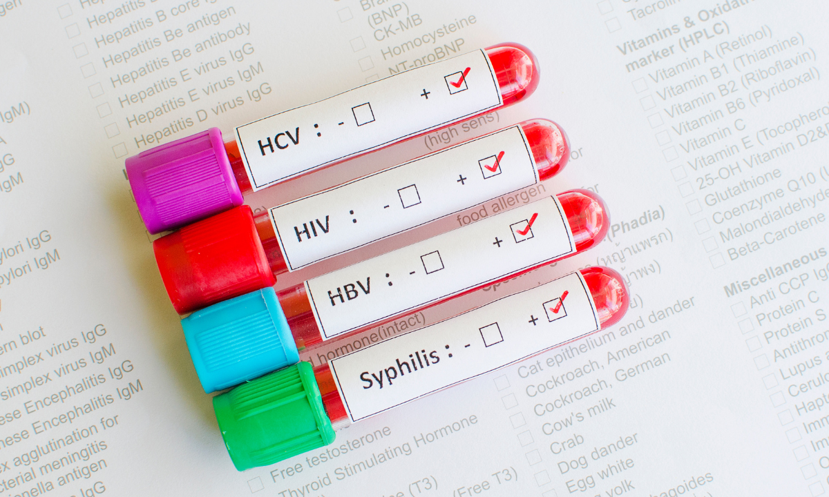 Image of a blood vial containing blood contaminated with STIs