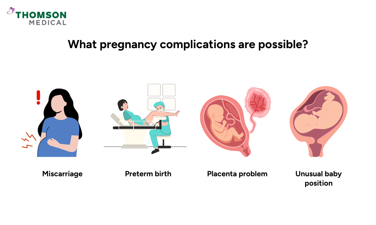 illustration of what pregnancy complication are possible