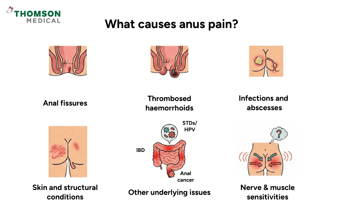 A visual guide highlighting various causes, including anal fissures, thrombosed haemorrhoids, infections and abscesses, skin and structural conditions, nerve and muscle sensitivities, and other underlying issues like IBD, STDs/HPV, and anal cancer.