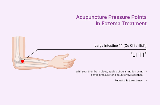 acupuncture-pressure-points-in-eczema-treatment-large-intestine-11-Qu-Chi.jpeg