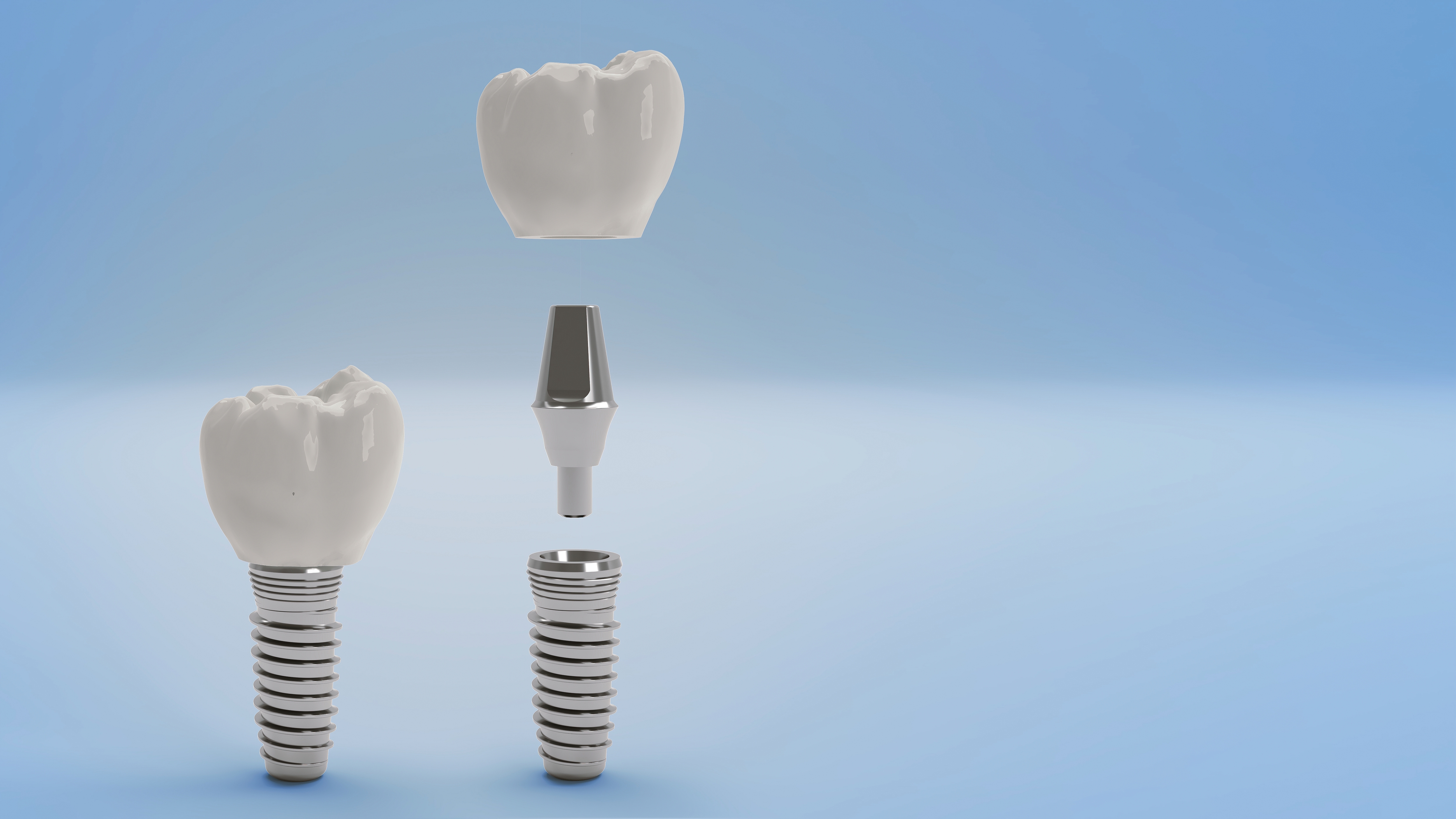 dental-implant.jpg