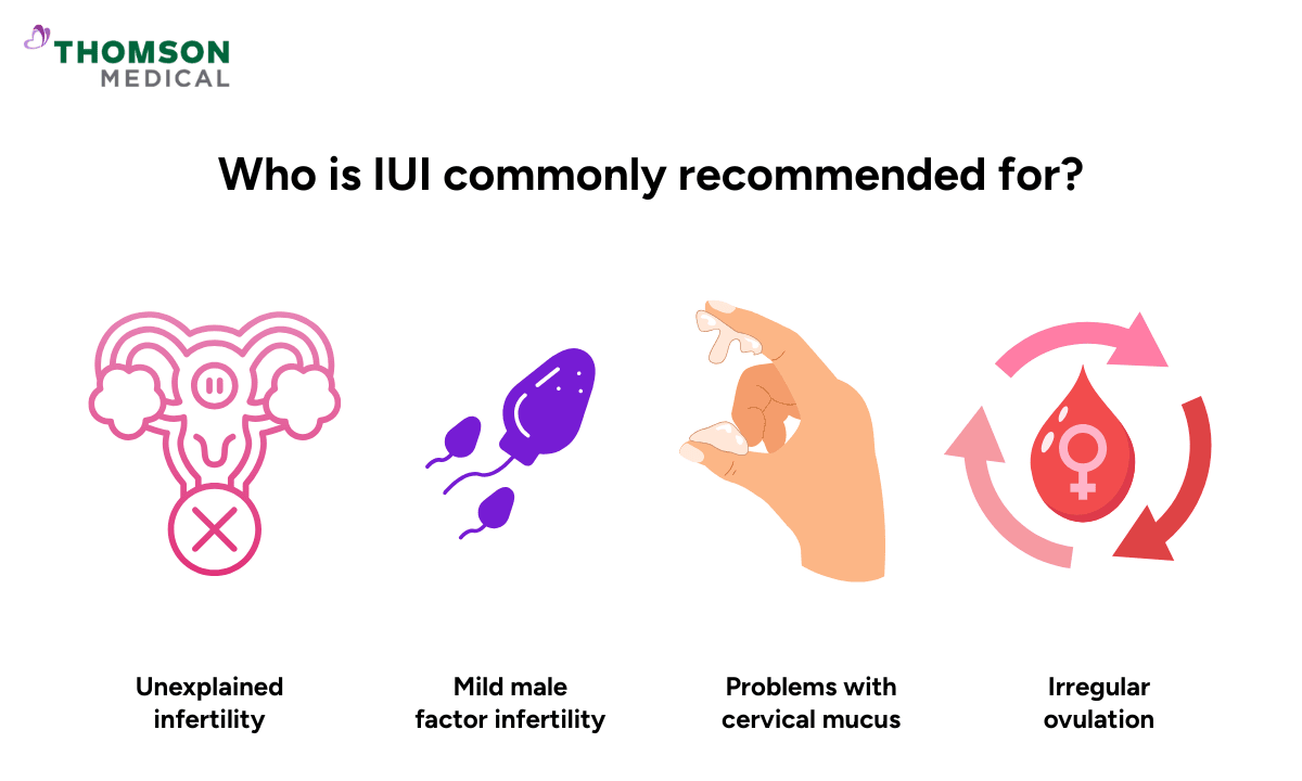 Who is IUI commonly recommended for?