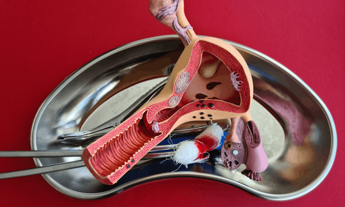 Illustration of women's reproductive organs
