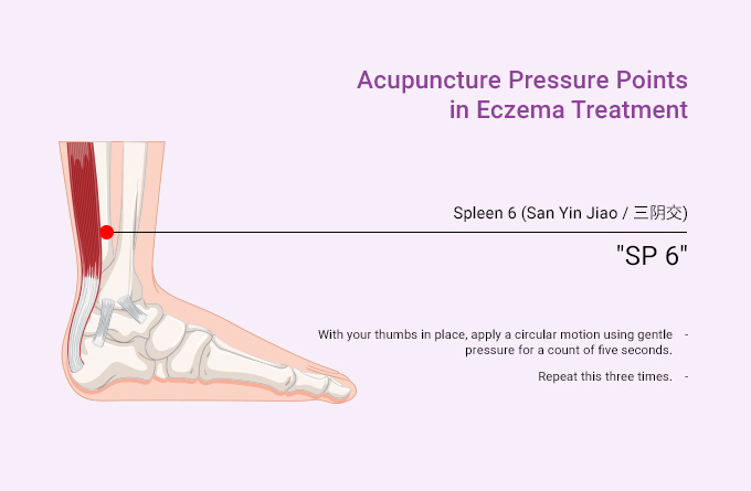 acupuncture-pressure-points-in-eczema-treatment-spleen-6-San-Yin-Jiao.jpeg