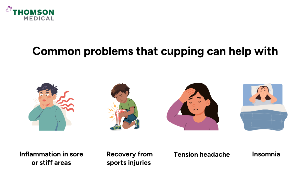common health issue cupping can help with