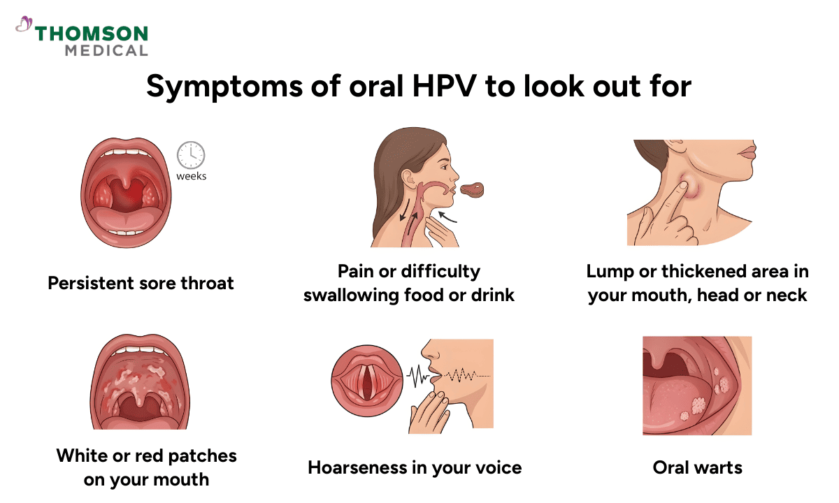 Infographic on symptoms of oral HPV to look out for, illustrating six signs: persistent sore throat, pain/difficulty swallowing, lumps in the mouth/neck, white or red patches, hoarseness, and oral warts.