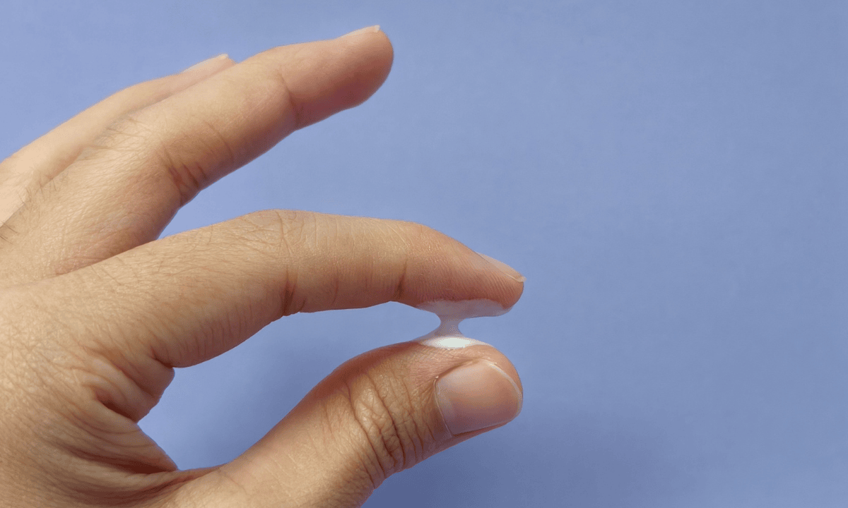 a-photo-of-vaginal-discharge