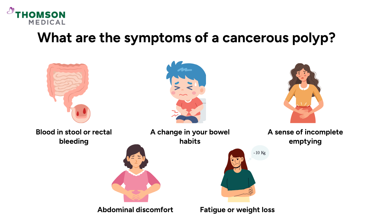 Infographic showing symptoms of a cancerous polyp