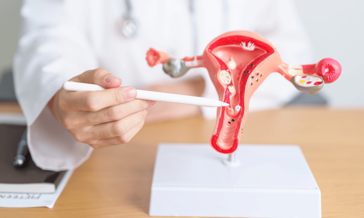 Doctor showing the location of cervical polyps.png