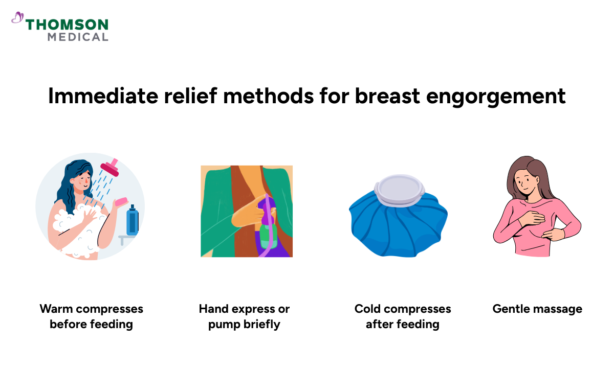 relief techniques for breast engorgement