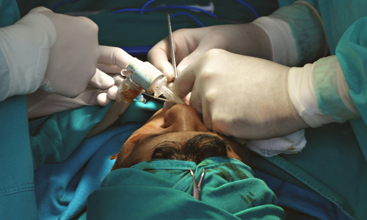 A patient undergoing jaw surgery