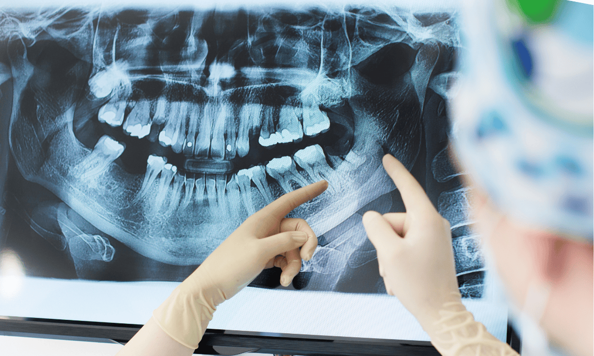 dentists examining dental X-ray result