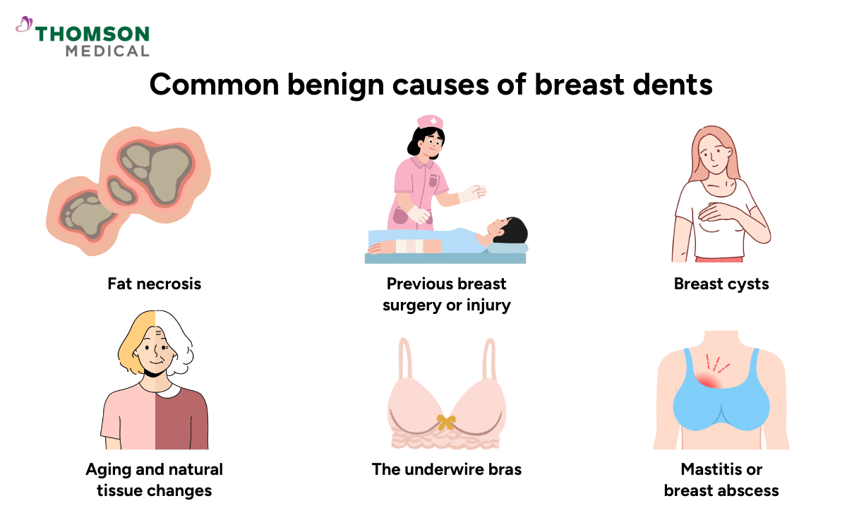common-benign-causes-of-breast-dents