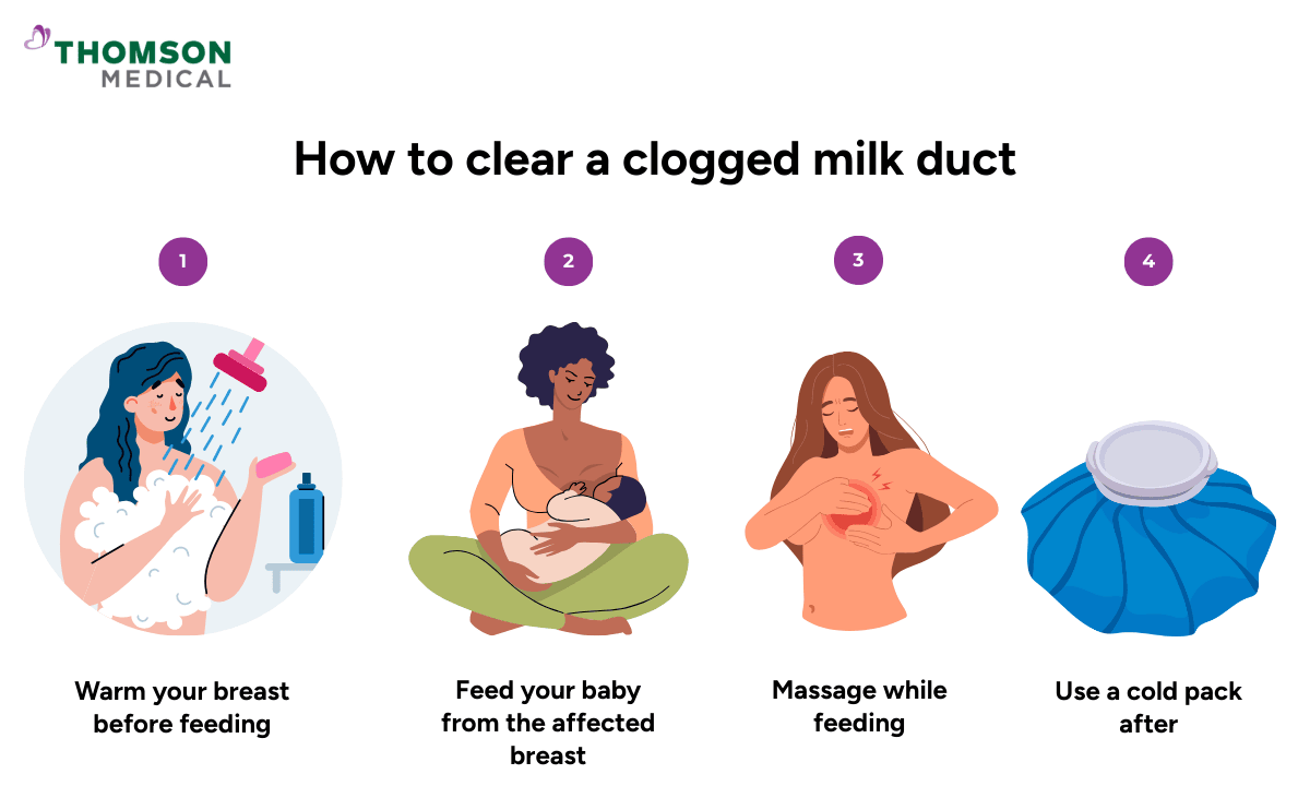 image of how to clear a clogged milk duct