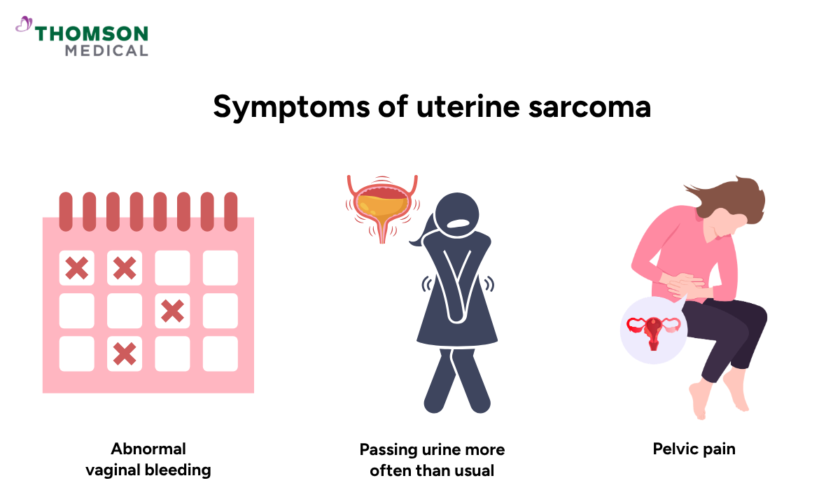 Illustration shows symptoms of uterine sarcoma