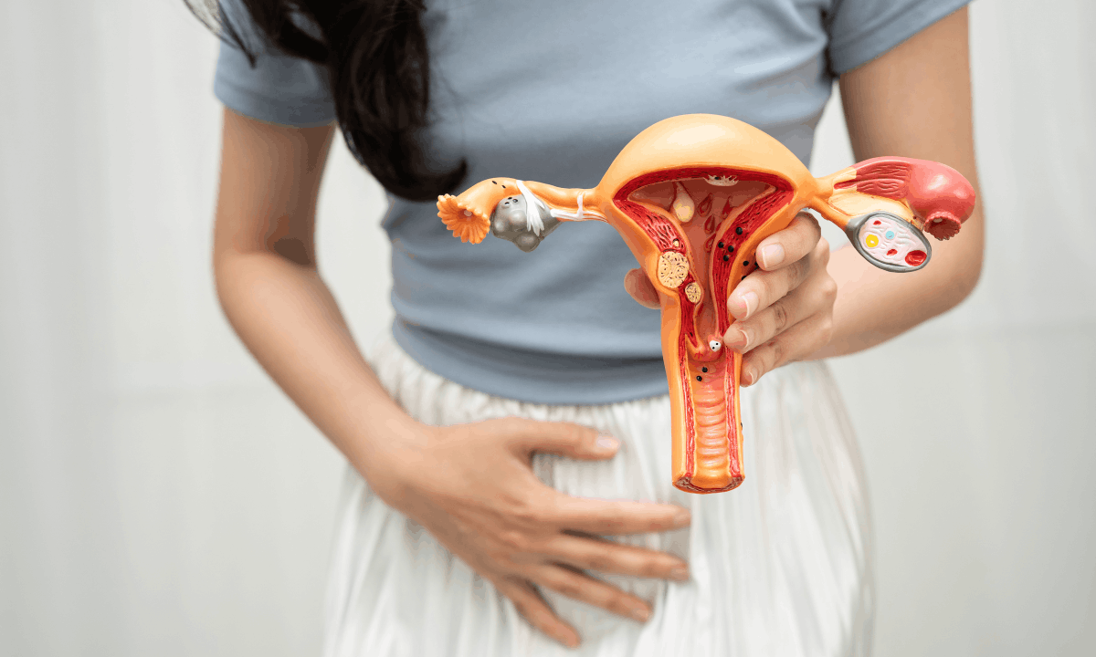 Illustration of women with endometrial cancer